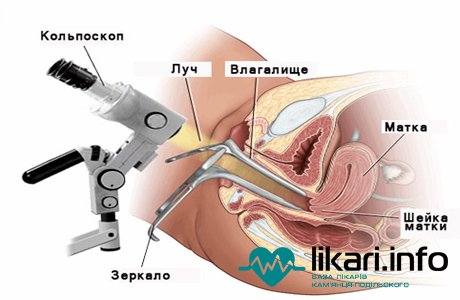 Гинеколог в Астане