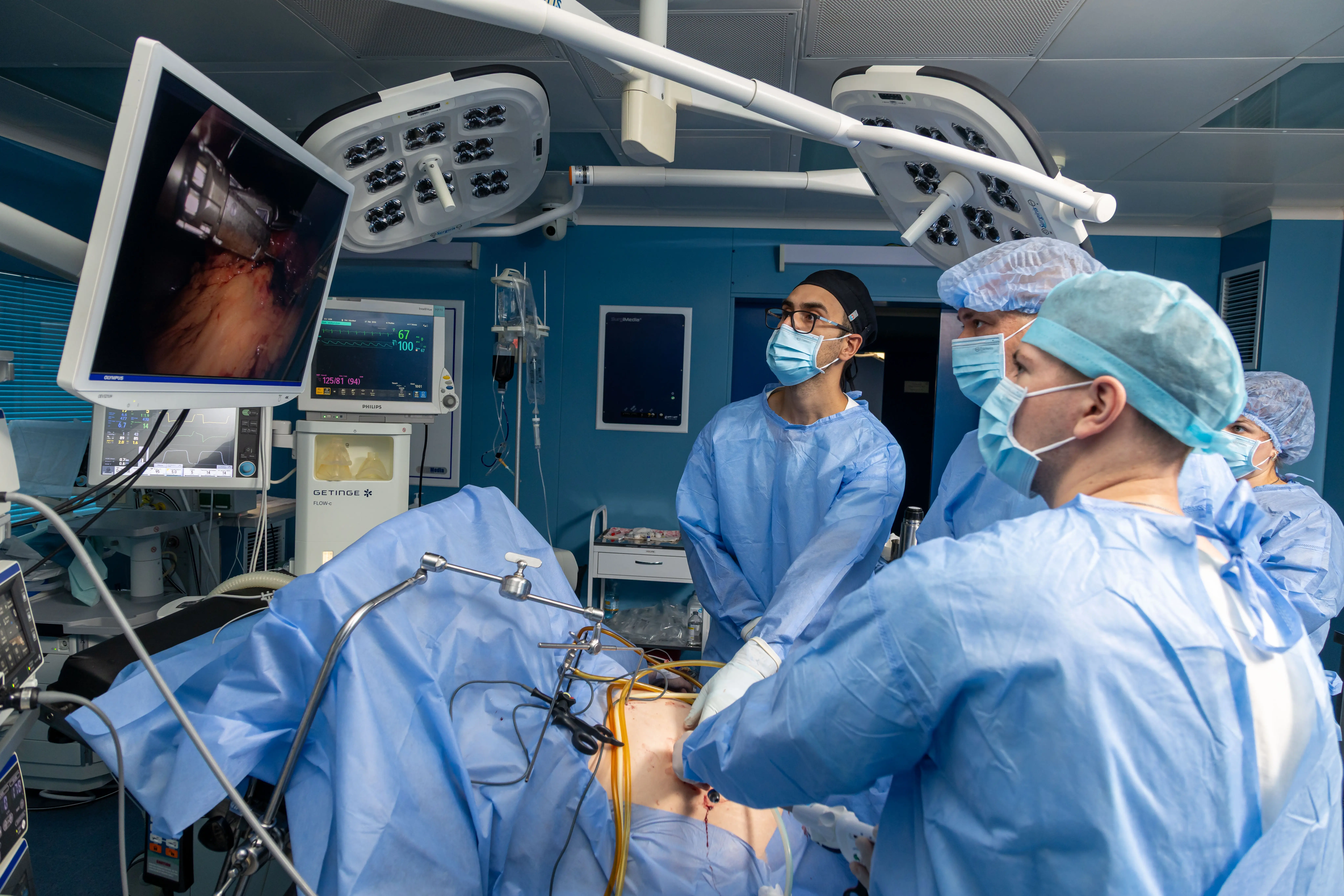 Баріатрична операція